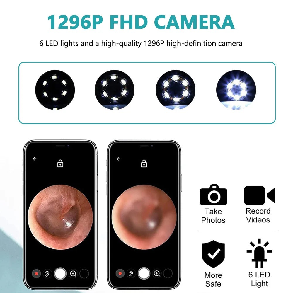 Intelligent Ear Wax Cleaner with 500MP Camera منظف الأذن الذكي بكاميرا 500