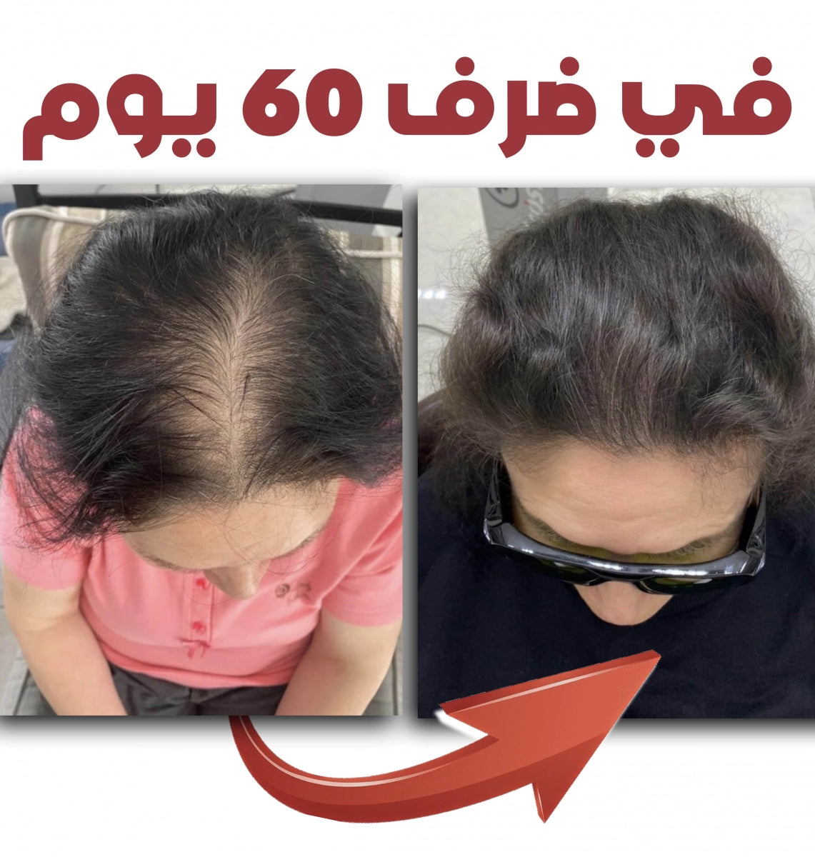BATANA KIT المجموعة السحرية | سيروم + شامبو