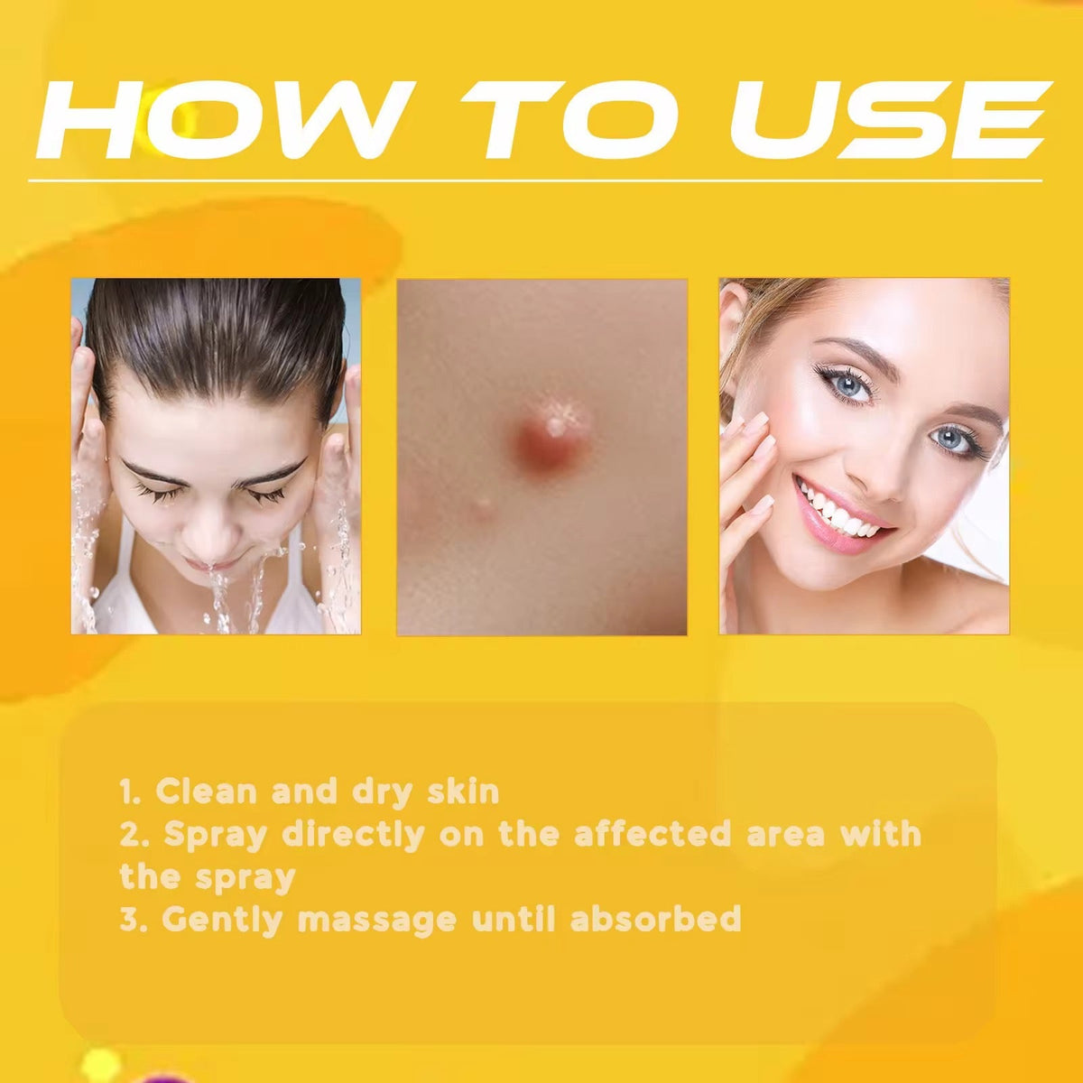 Skin Tag & Mole Remover Spray رشاش إزالة الزوائد الجلدية والشامات