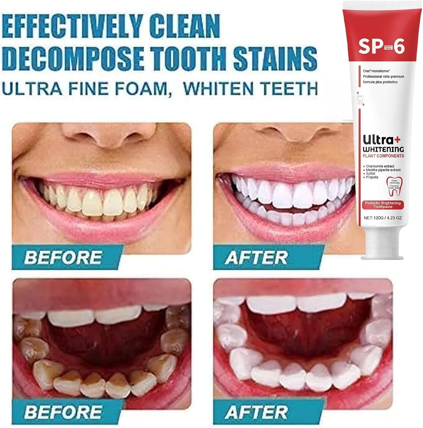 SP-6 Toothpaste Ultra Whitening