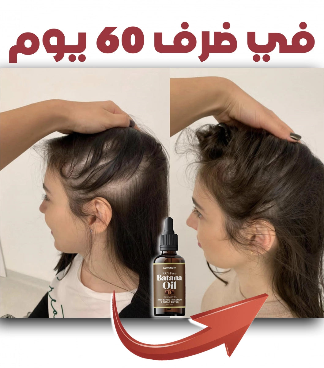 BATANA KIT المجموعة السحرية | سيروم + شامبو