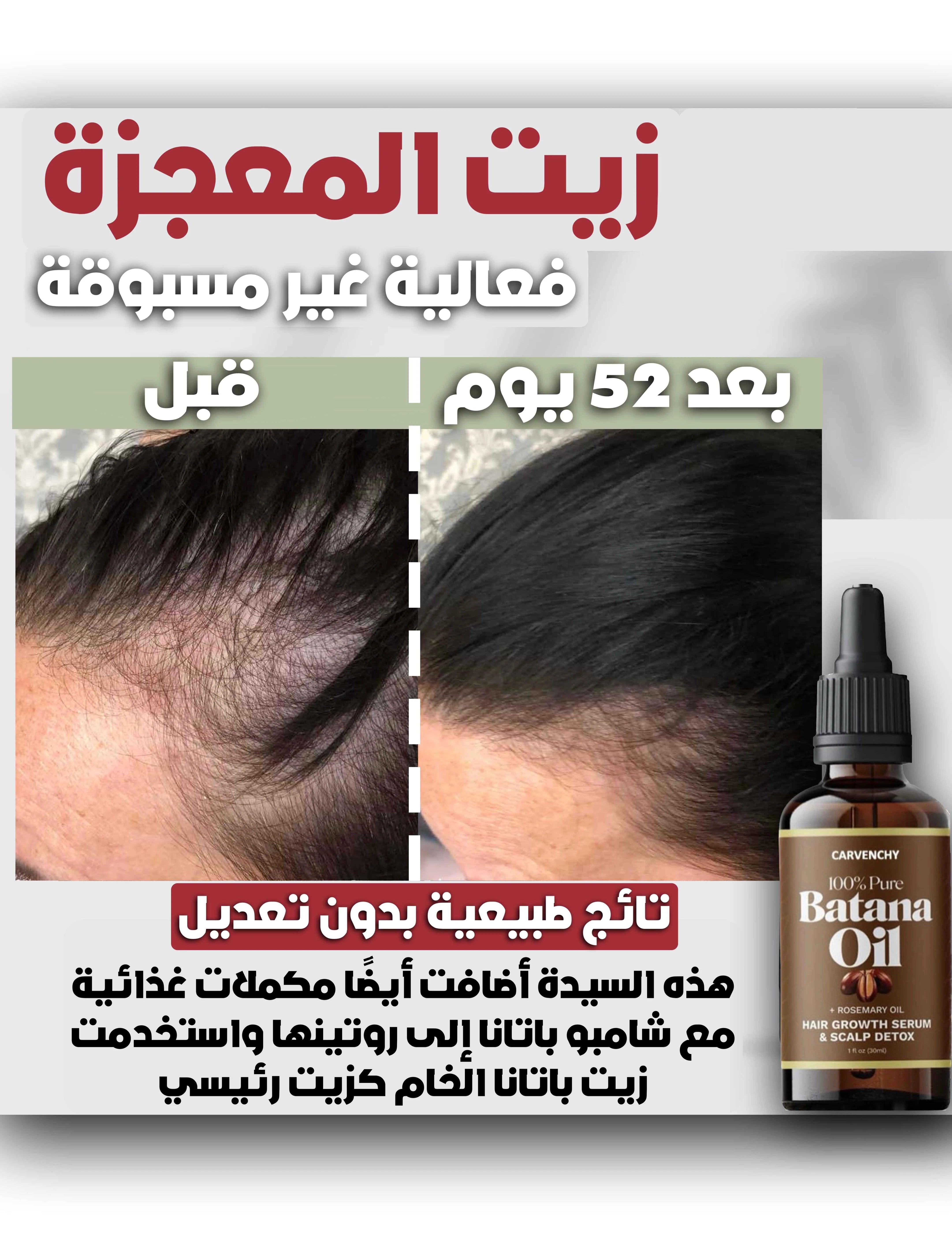 BATANA KIT المجموعة السحرية | سيروم + شامبو