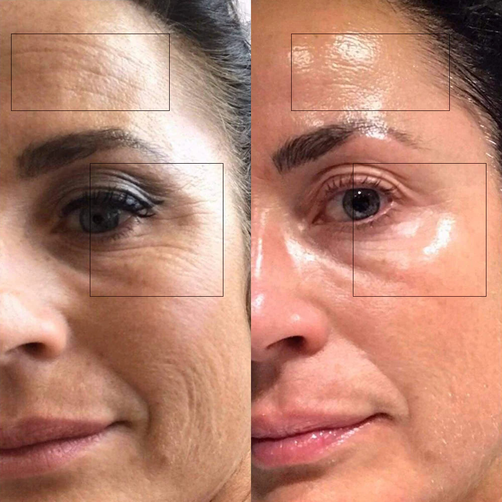KOREAN HIGHPRIME Collagen Film | Pack of 5 (Forehead, Cheek & Neck) فيلم كولاجين كوري فاخر | 5 قطع (جبهة وخدود ورقبة)