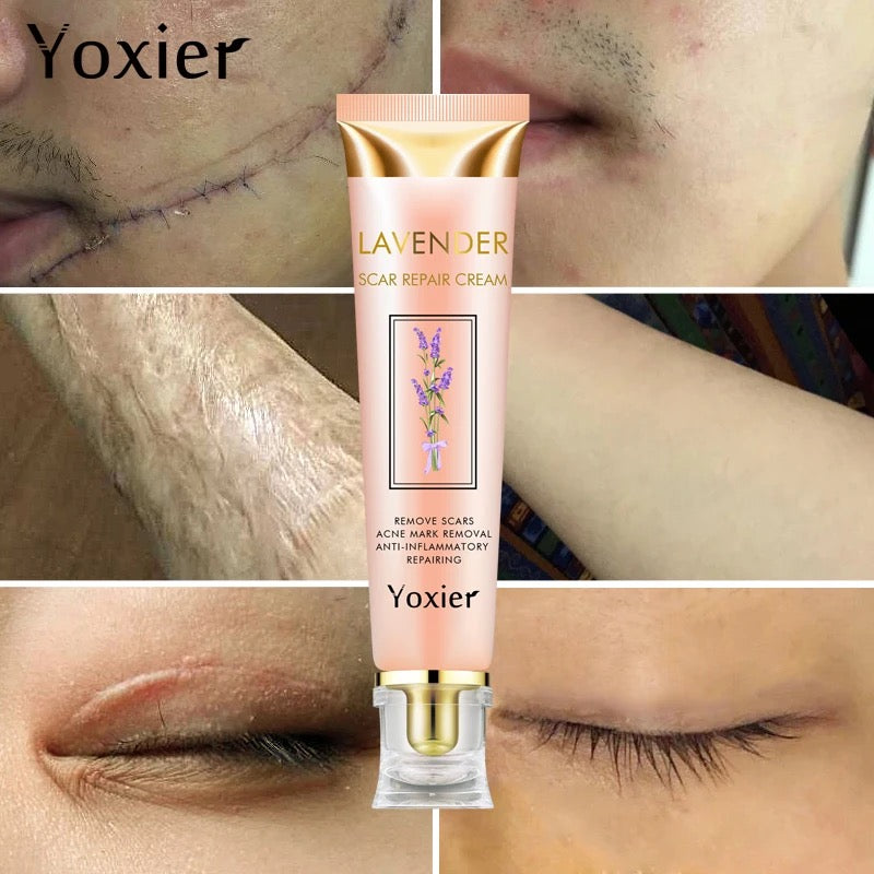 Yoxier Lavender Scar Repair Cream
