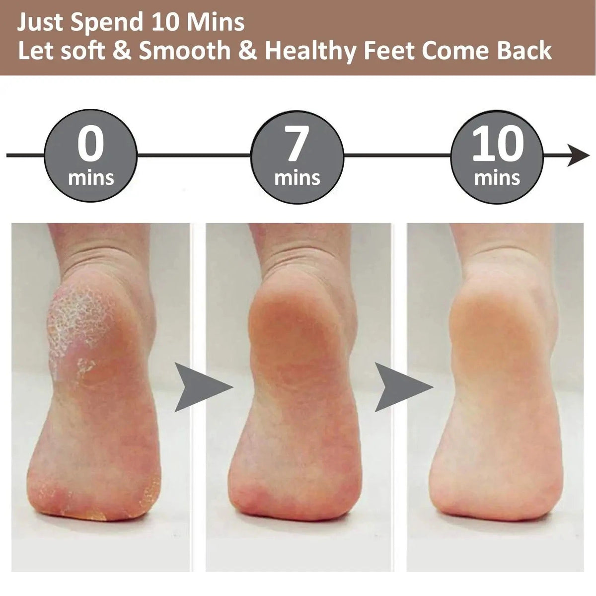 Dead Skin Feet & Callus Remover مزيل الجلد الميت والجلد المتصلب للقدمين