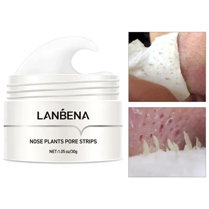 LANBENA™ Cream + Pore Strips (60PCS) كريم وشرائط المسام | 60 قطعة
