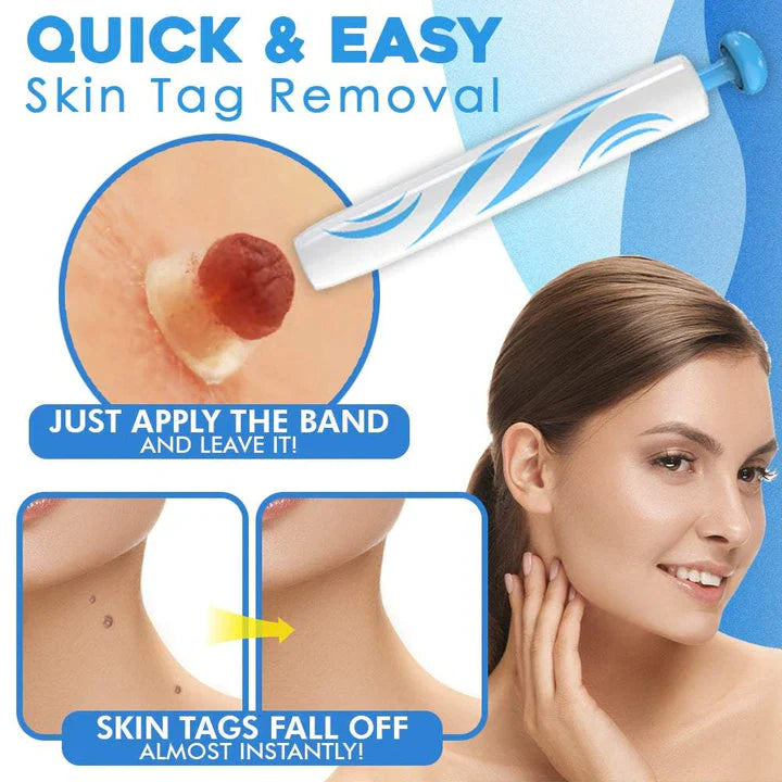 Skin Tag Removal Kit | Made In United Kingdom طقم إزالة الزوائد الجلدية | صنع بريطاني