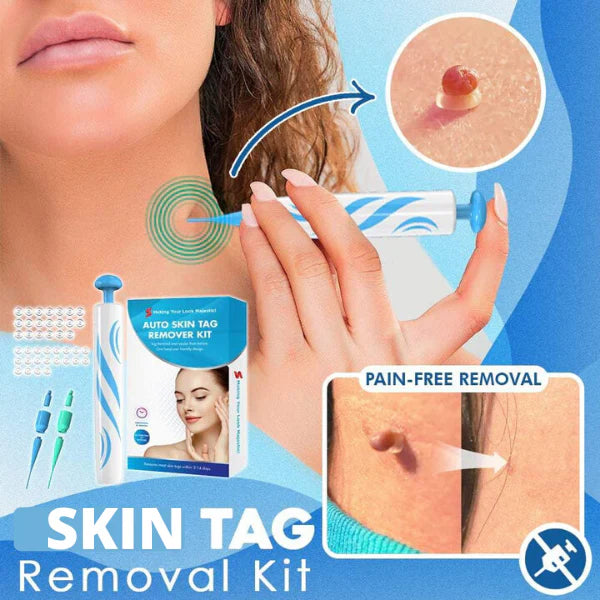 Skin Tag Removal Kit | Made In United Kingdom طقم إزالة الزوائد الجلدية | صنع بريطاني
