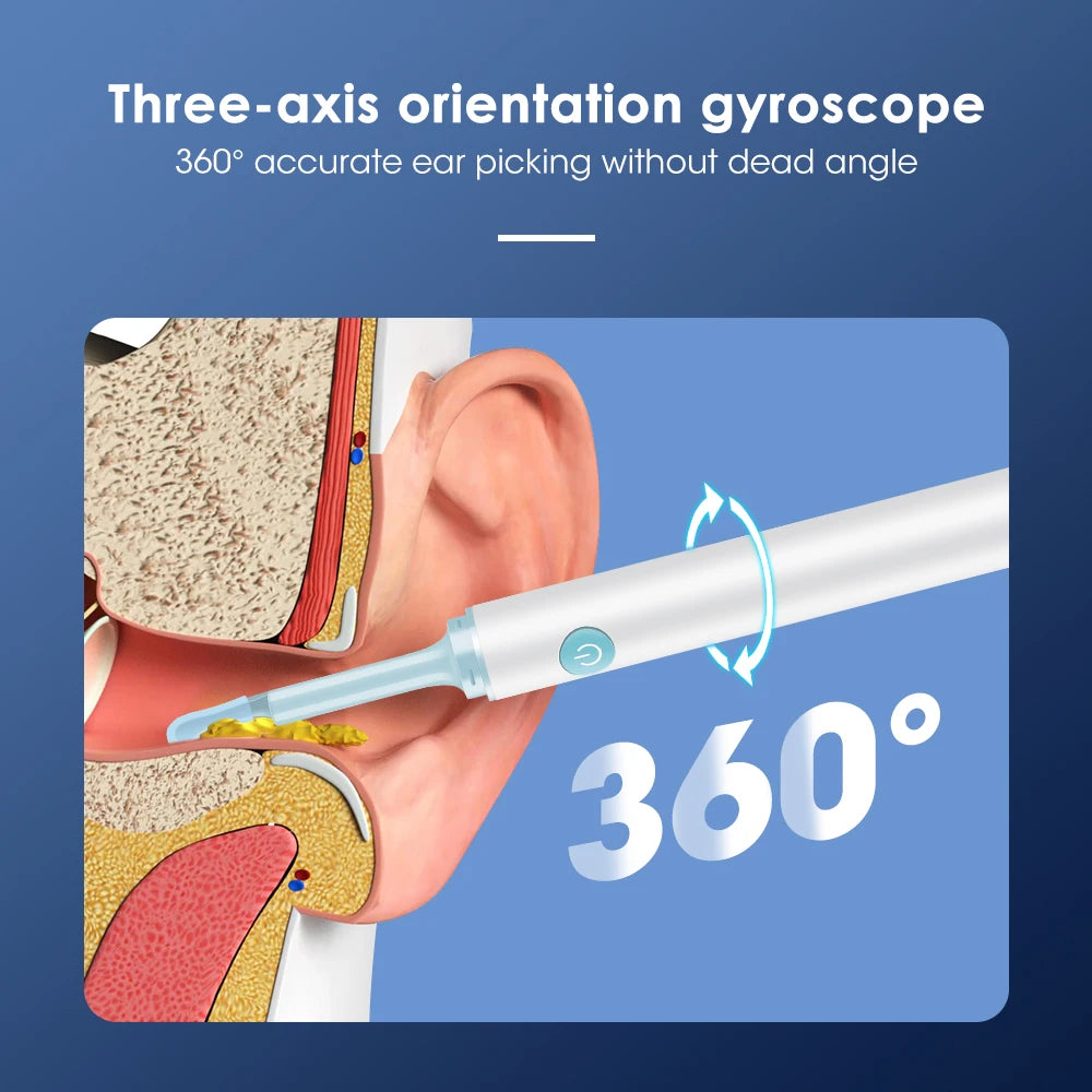 Intelligent Ear Wax Cleaner with 500MP Camera