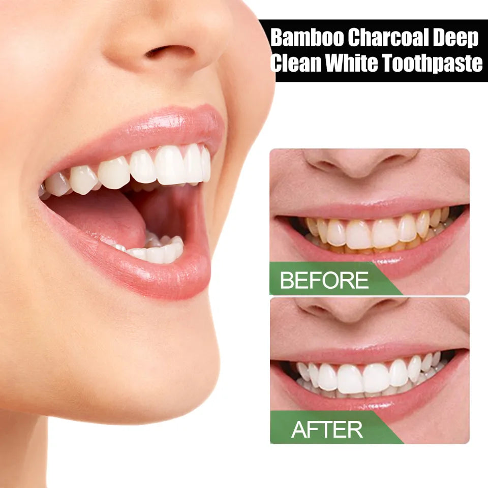 Bamboo Charcoal Toothpaste معجون أسنان بالفحم النباتي