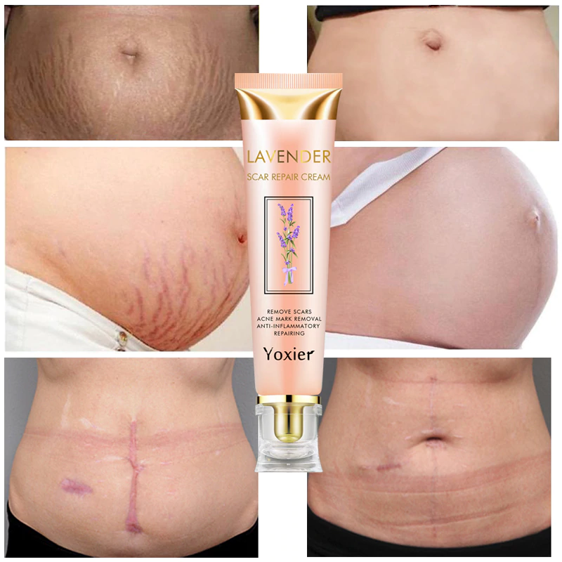 Yoxier Lavender Scar Repair Cream