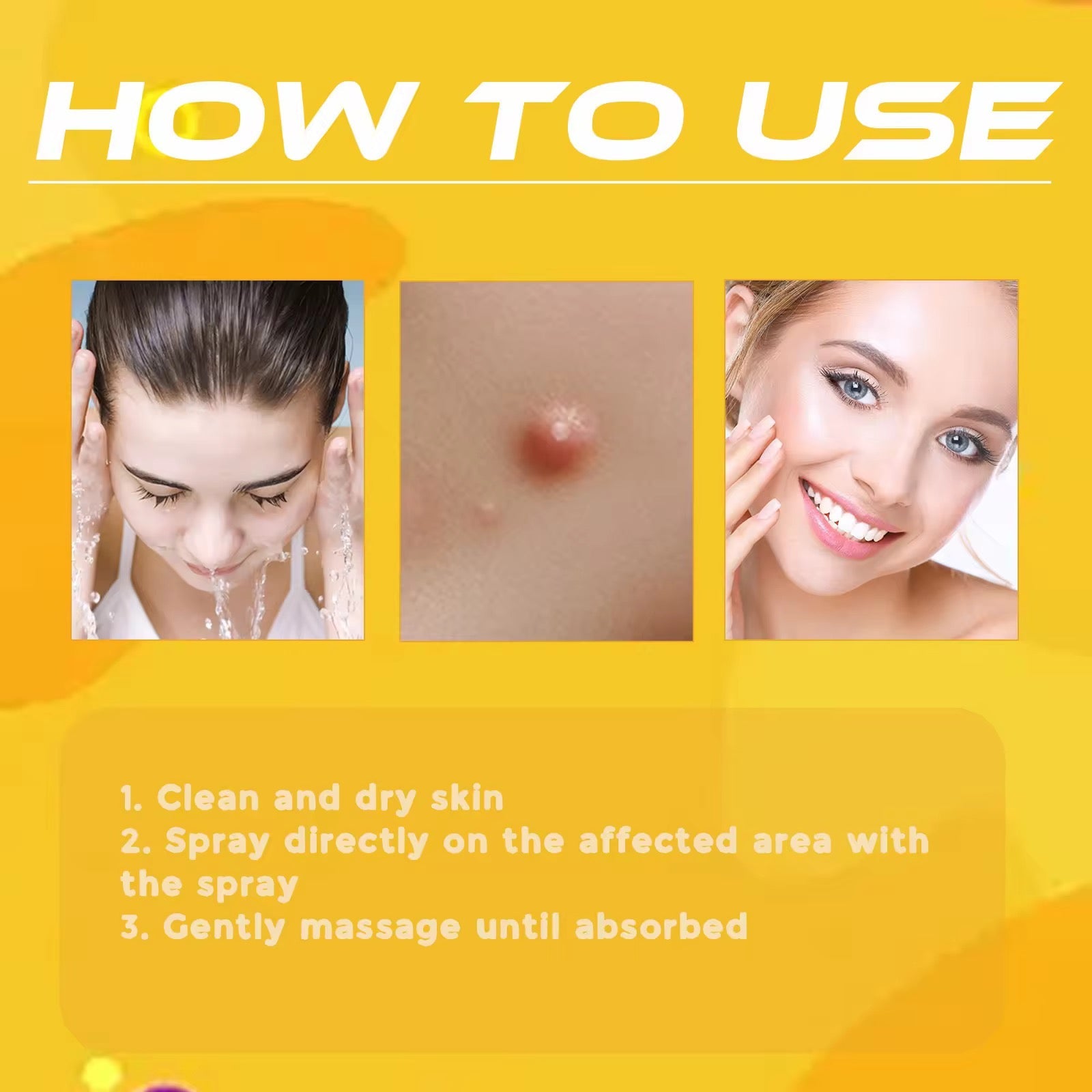 Skin Tag & Mole Remover Spray رشاش إزالة الزوائد الجلدية والشامات