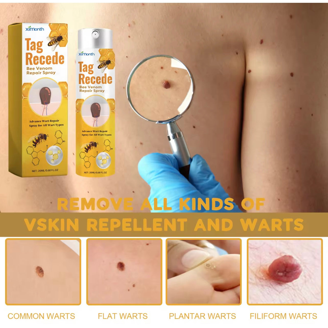 Skin Tag & Mole Remover Spray رشاش إزالة الزوائد الجلدية والشامات