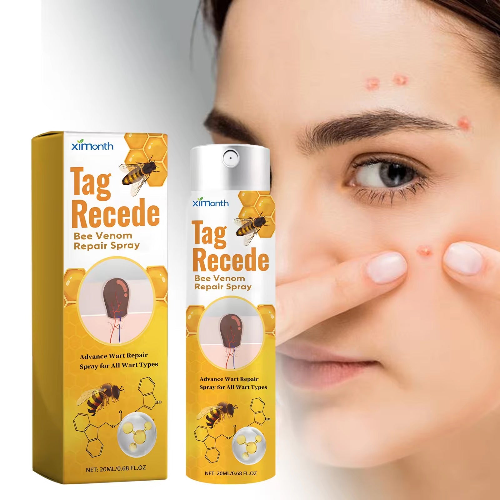 Skin Tag & Mole Remover Spray رشاش إزالة الزوائد الجلدية والشامات