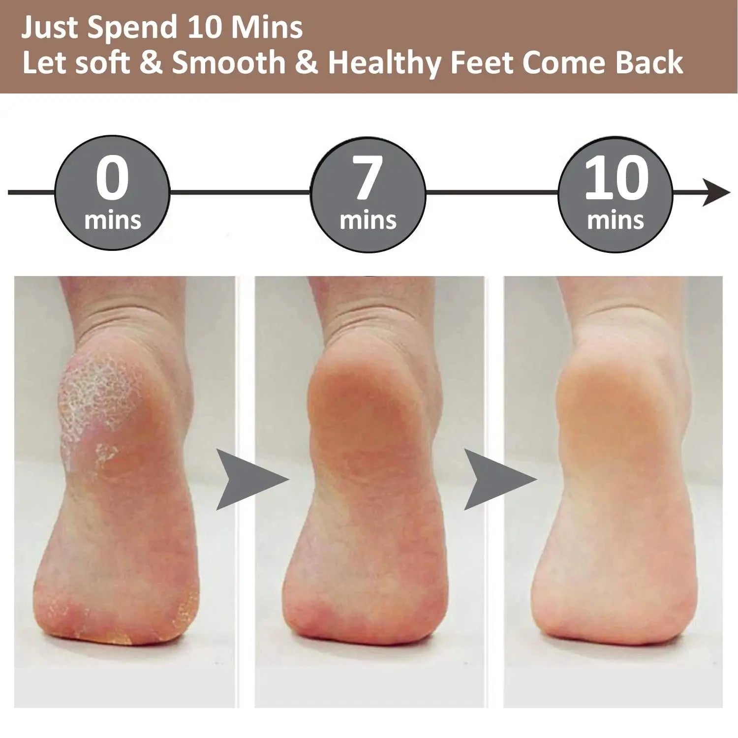 Dead Skin Feet & Callus Remover مزيل الجلد الميت والجلد المتصلب للقدمين