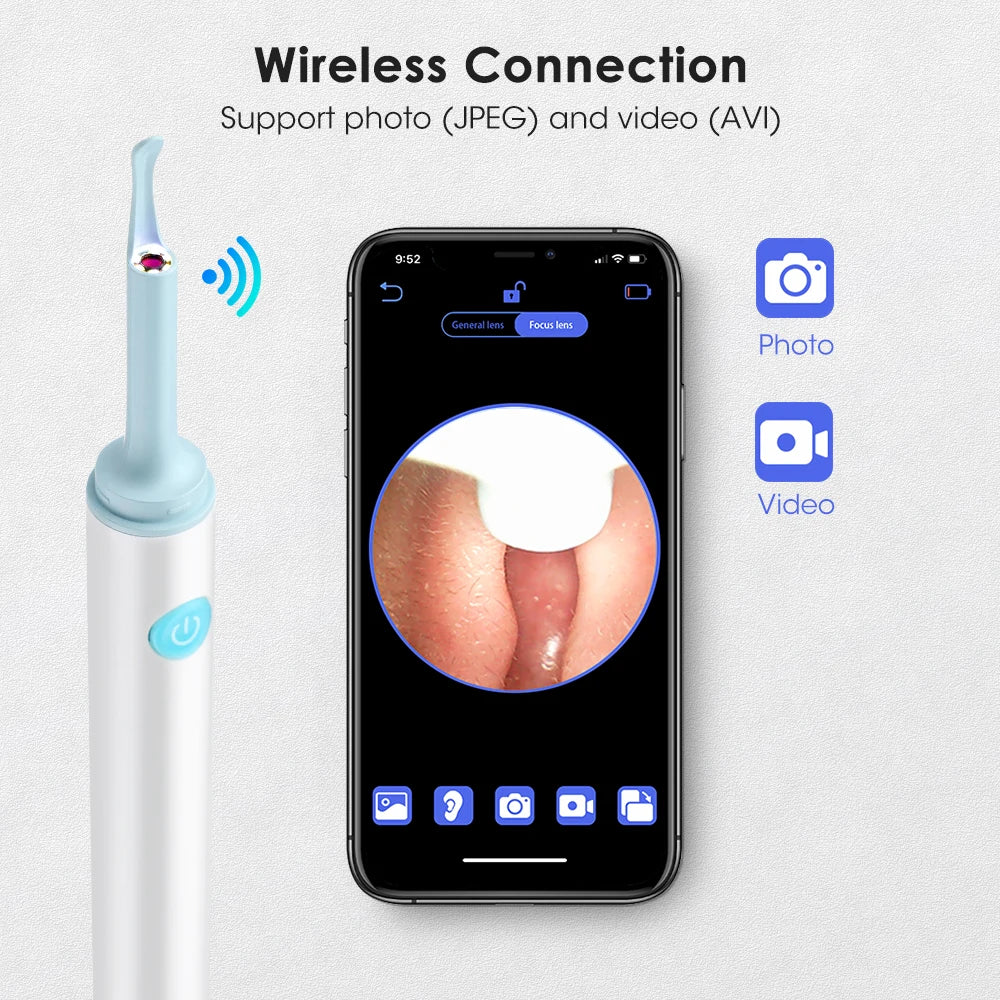 Intelligent Ear Wax Cleaner with 500MP Camera منظف الأذن الذكي بكاميرا 500